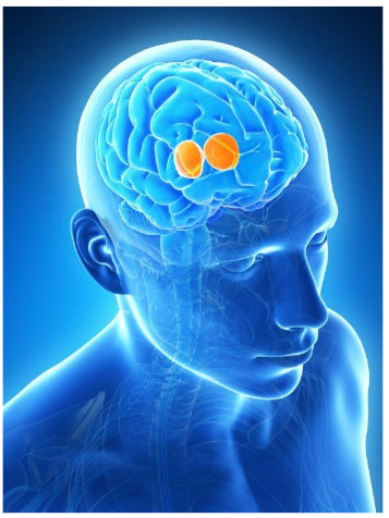 Ultrassom para o tratamento do Parkinson e do Tremor Essencial 
